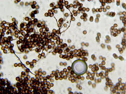 Attēlu rezultāti vaicājumam “Diderma chondrioderma spores”