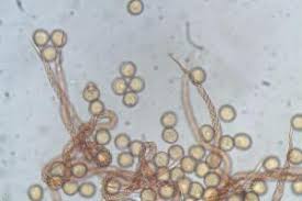 Attēlu rezultāti vaicājumam “Trichia botrytis var. cerifera”