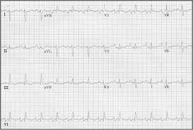 Image result for  ^ L V [ h    