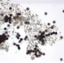 Attēlu rezultāti vaicājumam “Ophiotheca chrysosperma spores”