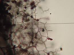 Attēlu rezultāti vaicājumam “Stemonaria irregularis spores”