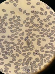 Attēlu rezultāti vaicājumam “Diderma cingulatum plasmodium”