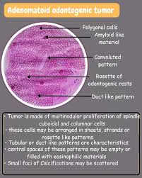 Attēlu rezultāti vaicājumam “Odontoschisma denudatum cells”