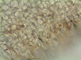 Attēlu rezultāti vaicājumam “Hymenoscyphus imberbis”