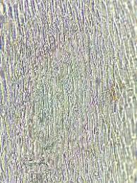 Attēlu rezultāti vaicājumam “Callicladium haldanianum”