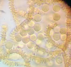 Attēlu rezultāti vaicājumam “Trichiaceae, Hemitrichiaceae, Arcyriaceae”