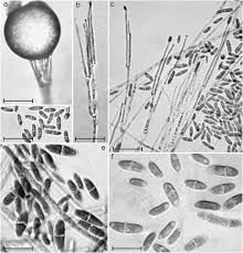 Attēlu rezultāti vaicājumam “Trichia erecta spores”