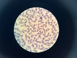 Attēlu rezultāti vaicājumam “Reticularia lobata plasmodium”