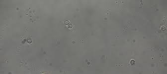 Attēlu rezultāti vaicājumam “Arcyria incarnata spores”