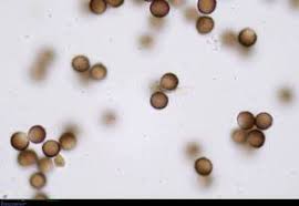 Attēlu rezultāti vaicājumam “Fuligo luteonitens”