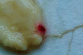 Attēlu rezultāti vaicājumam “Licea chelonoides”