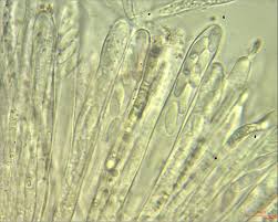 Attēlu rezultāti vaicājumam “Cudoniella clavus”