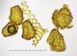 Attēlu rezultāti vaicājumam “Fossombronia wondraczekii sporophyte”