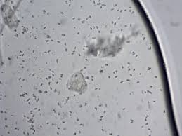 Attēlu rezultāti vaicājumam “Physarum penetrale stalked”