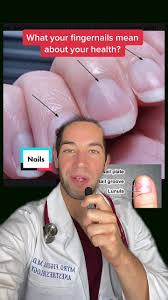 Image result for lunula nail