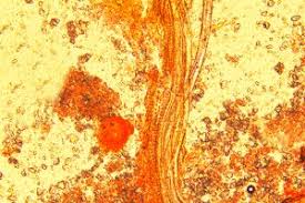 Attēlu rezultāti vaicājumam “Diderma chondrioderma sessile”