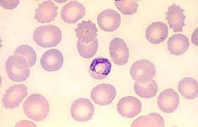 Attēlu rezultāti vaicājumam “Enteridium variabile plasmodium”