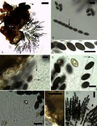 Attēlu rezultāti vaicājumam “Sordaria fimicola”