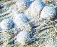 Attēlu rezultāti vaicājumam “Arthonia byssacea”