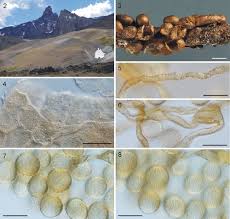 Attēlu rezultāti vaicājumam “Perichaena corticalis spores”