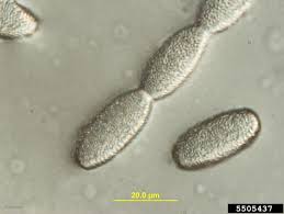 Attēlu rezultāti vaicājumam “Badhamia affinis var. microspora macro”