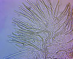 Attēlu rezultāti vaicājumam “Hypocrea pulvinata”