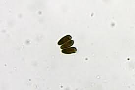 Attēlu rezultāti vaicājumam “Lycogala asperum macro”