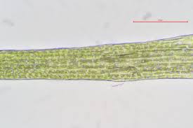 Attēlu rezultāti vaicājumam “Licea pusilla sessile”
