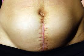 Image result for cesarskie