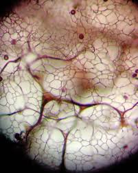 Attēlu rezultāti vaicājumam “Stemonitis lignicola spores”
