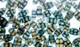 Attēlu rezultāti vaicājumam “Enteridium corticatum spores”