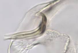 Attēlu rezultāti vaicājumam “Tanytarsus”