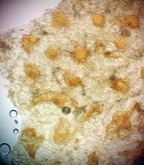 Attēlu rezultāti vaicājumam “Lycogala ustulatum”