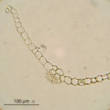 Attēlu rezultāti vaicājumam “Acaulon muticum sporophyte”
