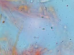 Attēlu rezultāti vaicājumam “Flaviporus citrinellus”