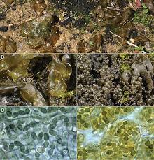 Attēlu rezultāti vaicājumam “Nostoc commune cells”