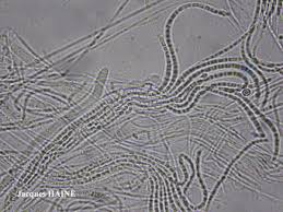 Attēlu rezultāti vaicājumam “Stictis”