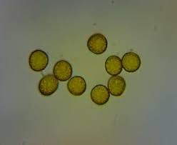 Attēlu rezultāti vaicājumam “Trichia varia spores”