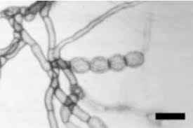 Attēlu rezultāti vaicājumam “Trichia longipalpis spores”