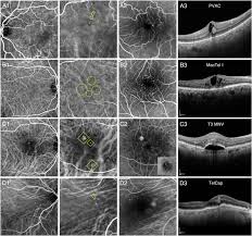 「pvAj[MjA」の画像検索結果