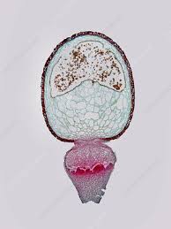 Attēlu rezultāti vaicājumam “Sphagnum austinii sporophyte”