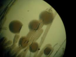Attēlu rezultāti vaicājumam “Amaurochaete fusiformis spores”