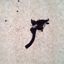 Attēlu rezultāti vaicājumam “Chaenotheca brunneola”