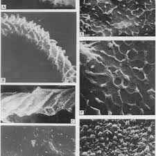Attēlu rezultāti vaicājumam “Heterotrichia pomiformis (syn. Arcyria pomiformis)”