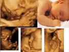 O setor de <b>ultra</b>-<b>sonografia</b>