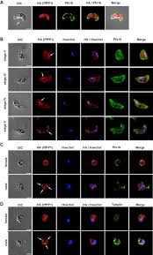 Attēlu rezultāti vaicājumam “Dianema depressum plasmodium”