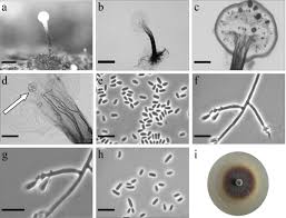 Attēlu rezultāti vaicājumam “Ophiotheca chrysosperma spores”