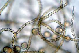 Attēlu rezultāti vaicājumam “Diachea leucopodia young”