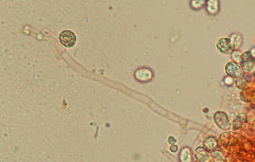 Attēlu rezultāti vaicājumam “Radulomyces confluens”