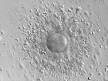 In vitro fertilisation - Wikipedia, the free encyclopedia